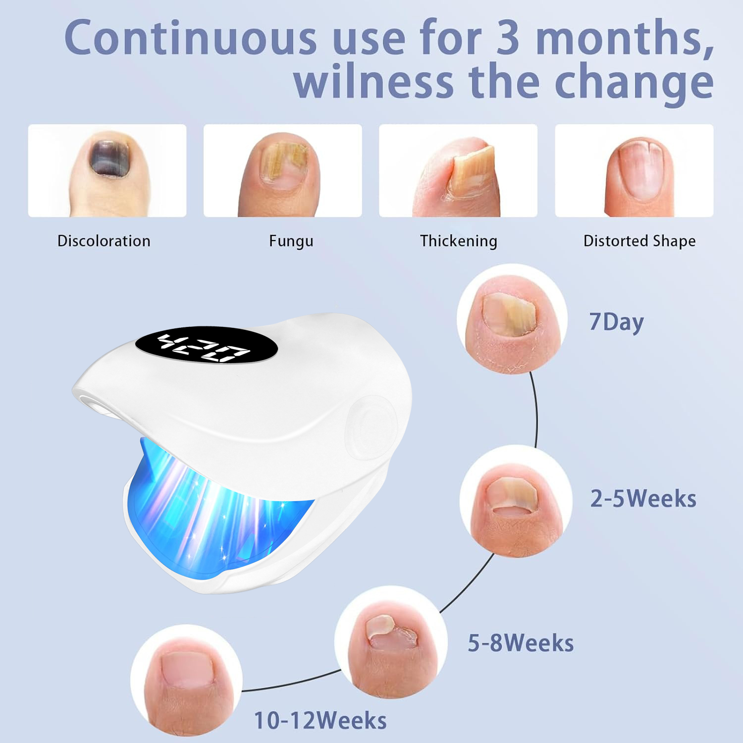 USB Charging Nail Fungus Treat - огляд і ціна Galvanic Skin Sensor